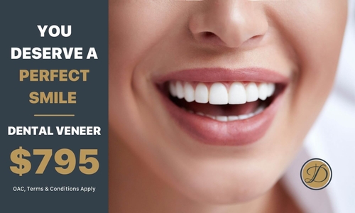 6684186c74b021d34b0a20e4 henderson dental veneers 2 p 500