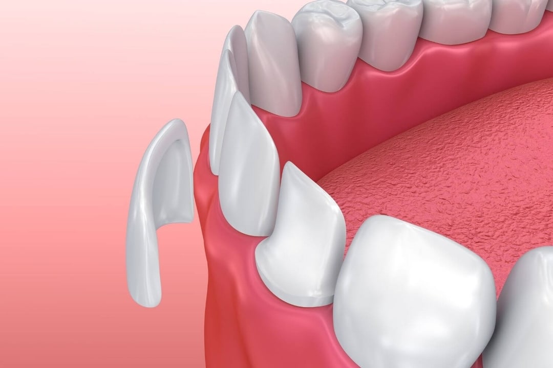6684186c74b021d34b0a2180 dentisthenderson comp p 1080