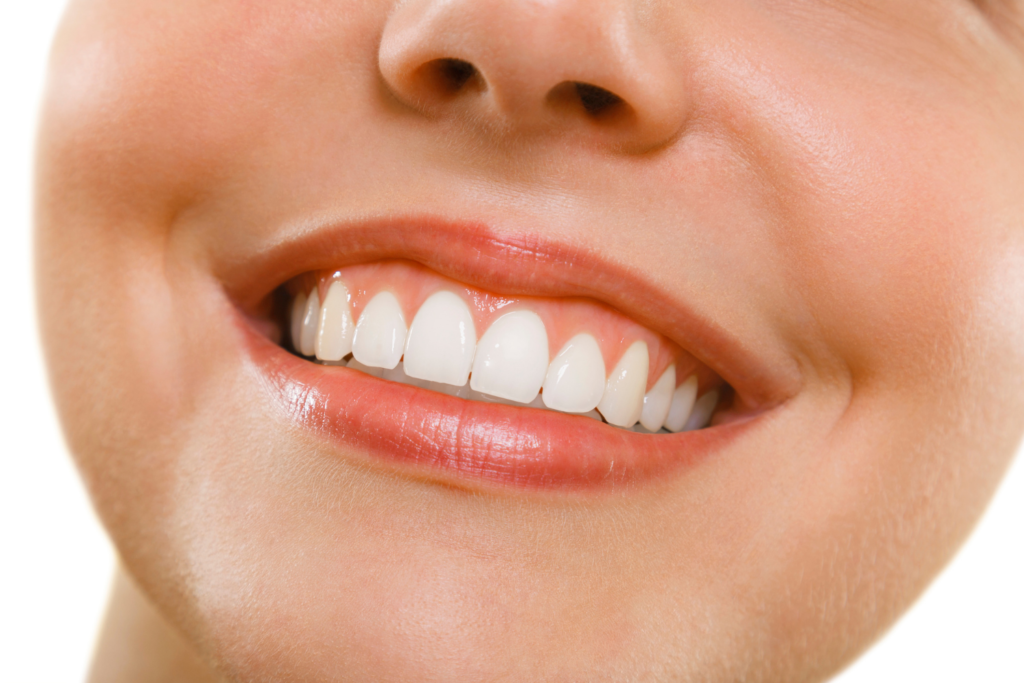6684186c74b021d34b0a219e dental veneers las vegas 1