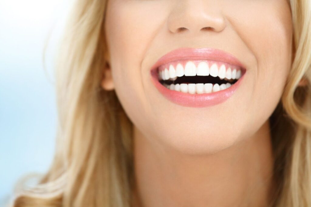 6684186c74b021d34b0a21a3 dental veneers henderson 3 1