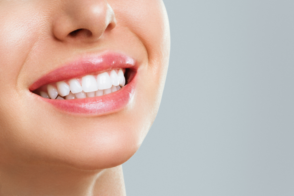 6684186c74b021d34b0a21b3 Henderson Veneers 19 1